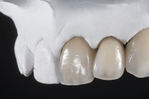 Odontotecnici 1